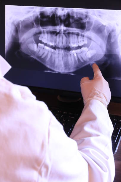 Best Emergency Tooth Extraction in Livingston, TX